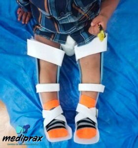 Ortesis Para La Corrección Del Genu Varo Y Genu Valgo -Mediprax