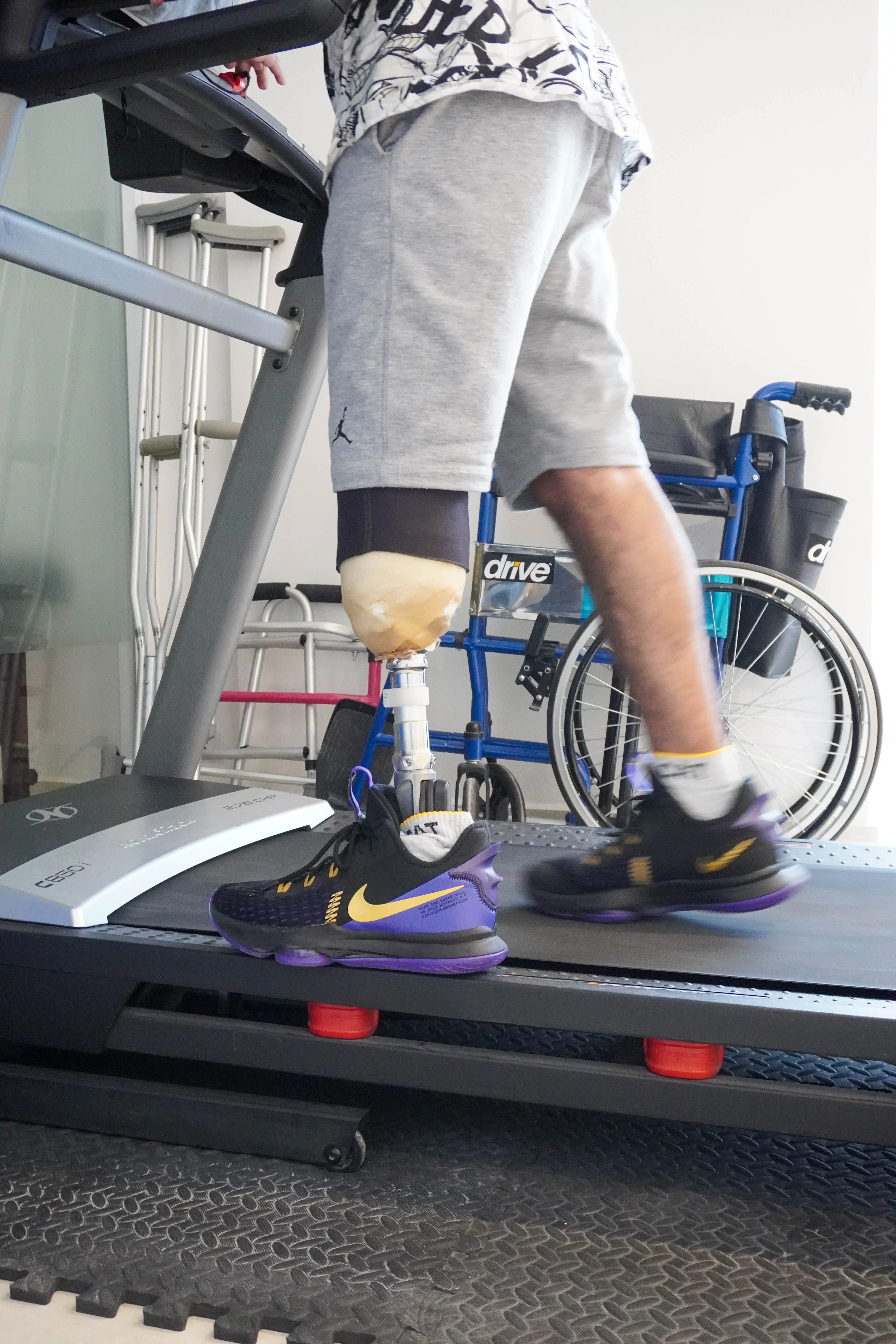 Adaptacion protesica protesis transtibial