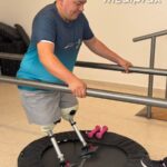 rehabilitacion-protesica